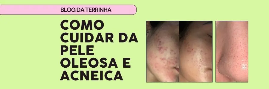 O que usar em peles oleosas e acneicas?